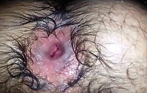 Gaping