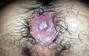 Gaping